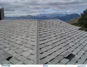 Shingles